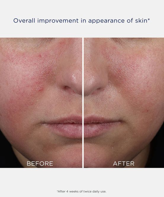 Hovedbilde Mandelic Clarifying Hydragel