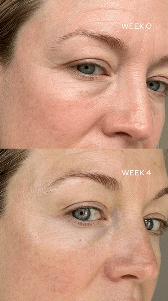 Eye Activator Serum
