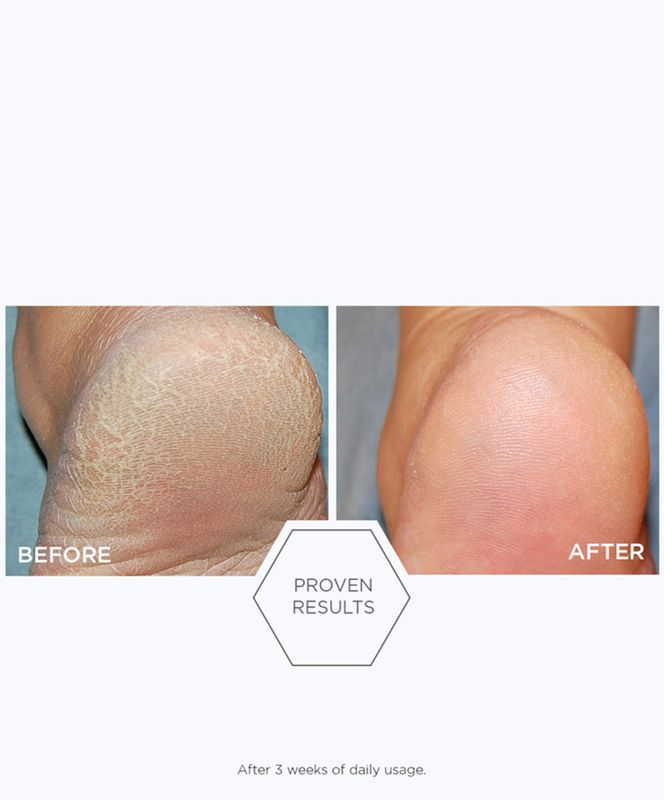 Problem Dry Skin Cream
