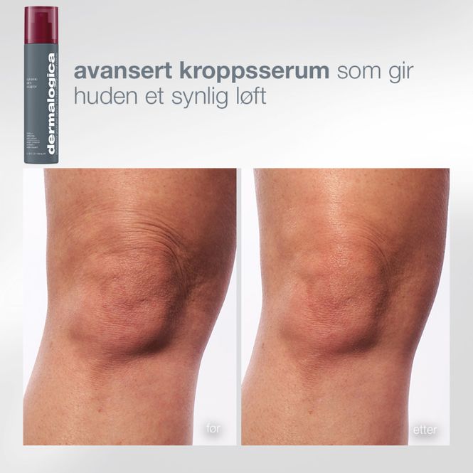 Hovedbilde The Body Reset