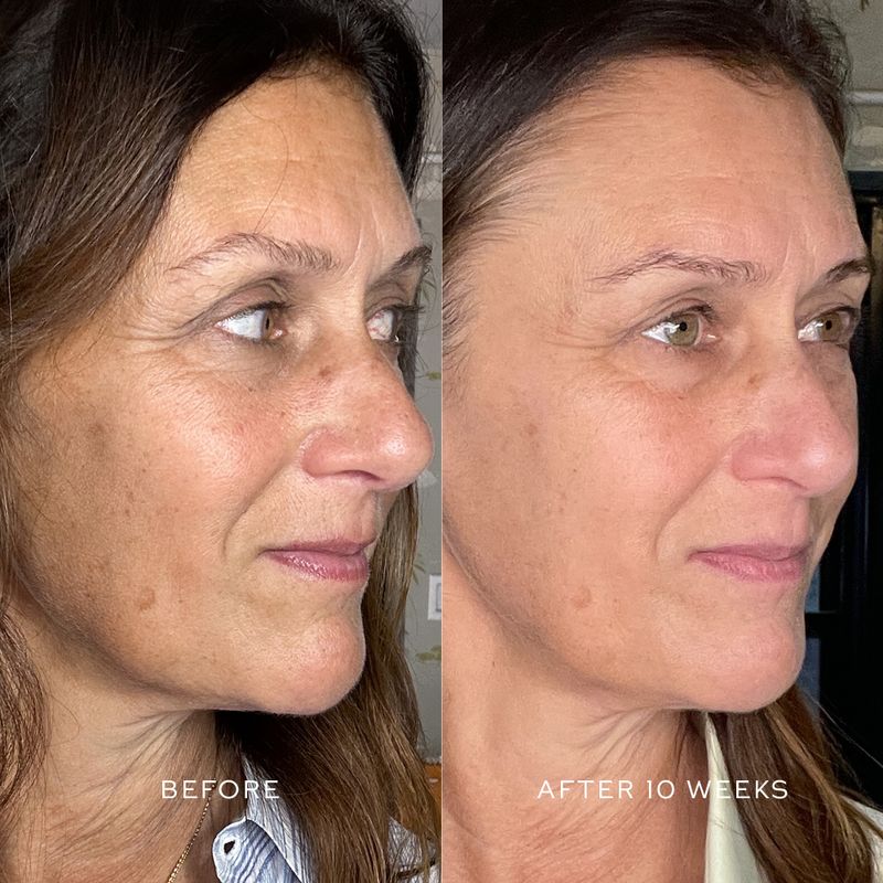 Suprême C Serum
