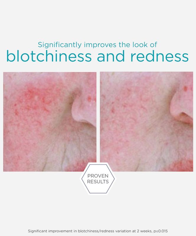 Redness Neutralizing Serum